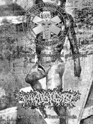 Streptococcus Pyogenes : Three Years of Pathological Goregrind - Lessons in Thanatopraxis